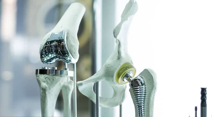 Mechanical prosthetic