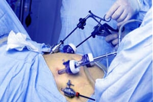 Minimally Invasive Surgical Instruments