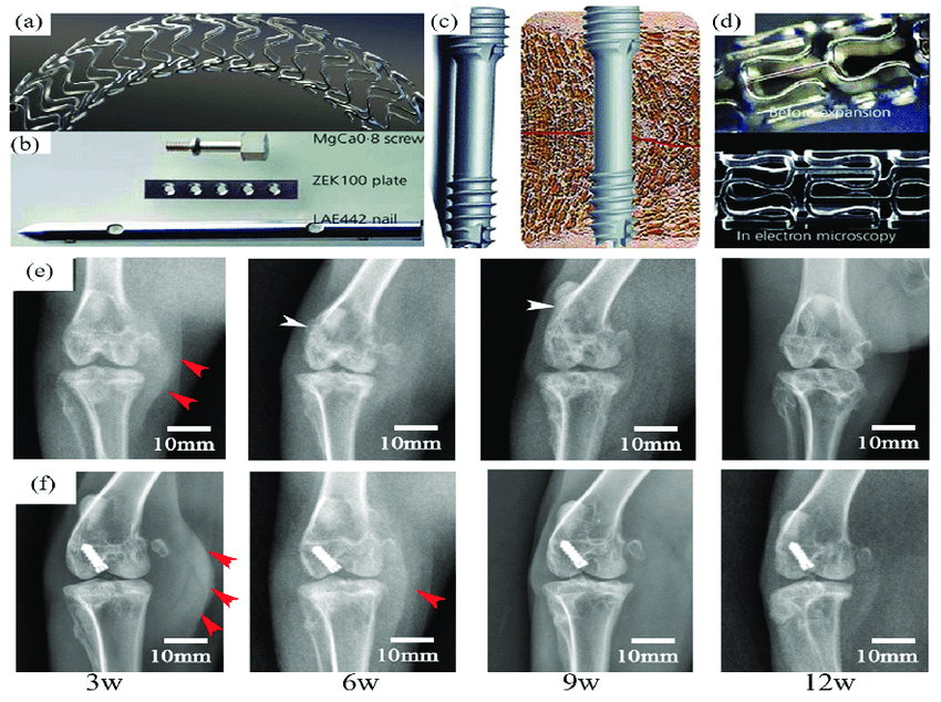 Biodegradable Implants