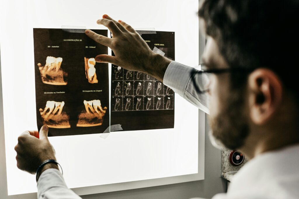 Digital X-ray Machine