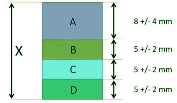 what is tolerance stacking